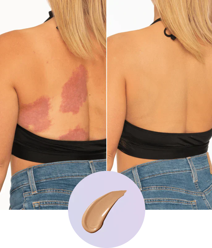 Body Coverage Perfector – Body Makeup for the Face, Arms & Body