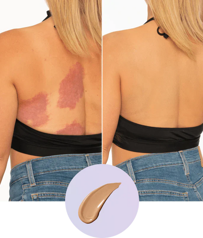 Body Coverage Perfector – Body Makeup for the Face, Arms & Body